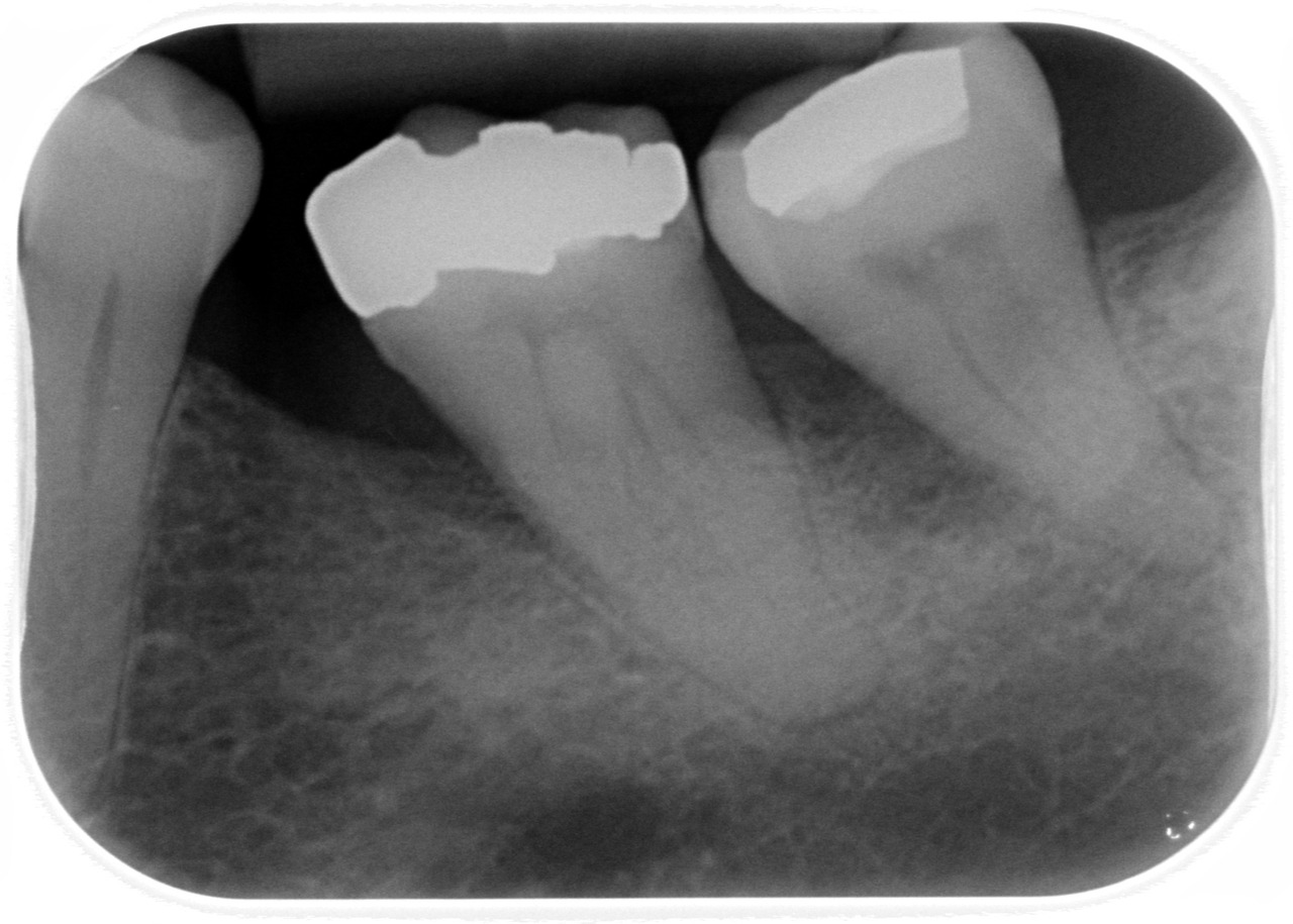 Good teeth, bad teeth